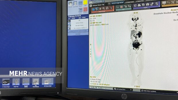 افزایش امید بیماران سرطانی به درمان؛ شکوفایی پزشکی هستهای در بوشهر