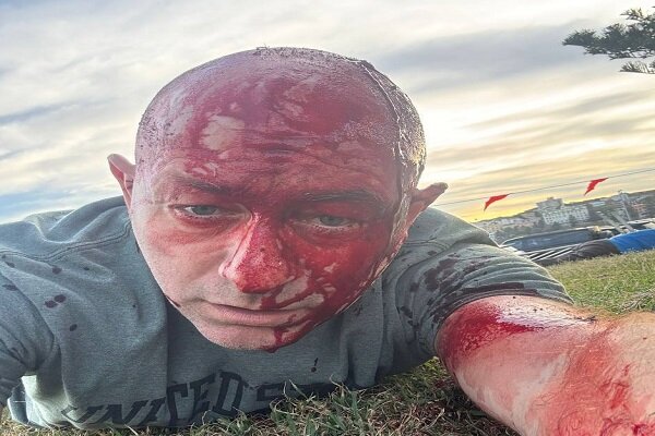 حاخام معروف در حنوکای خونین کشته شد